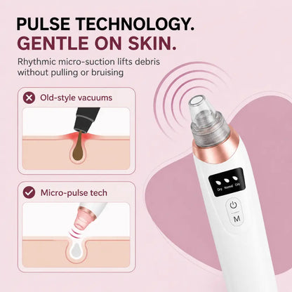 Facital Pore Remover