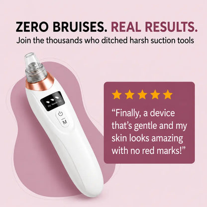 Facital Pore Remover