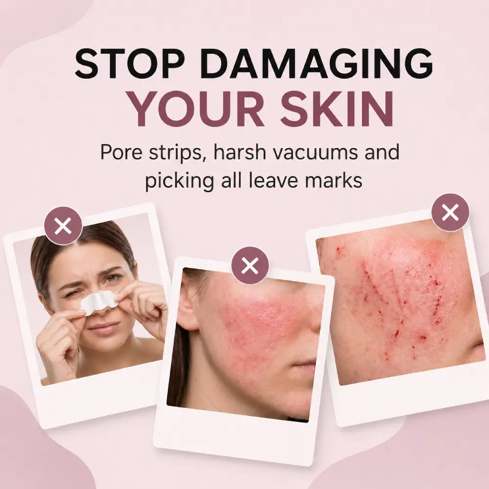Facital Pore Remover
