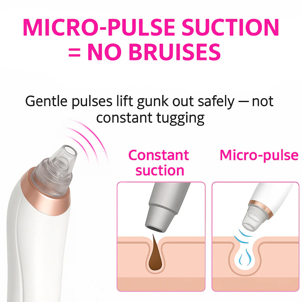 Facital Pore Remover