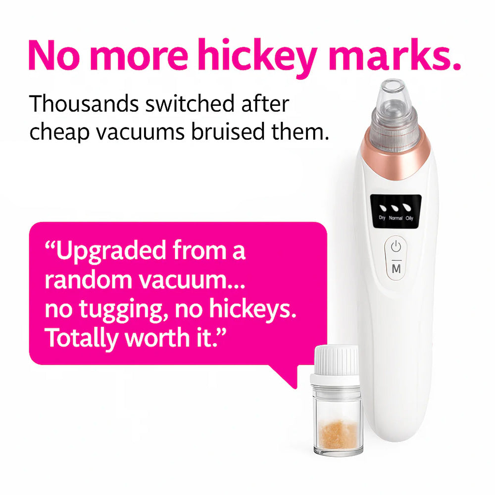 Facital Pore Remover