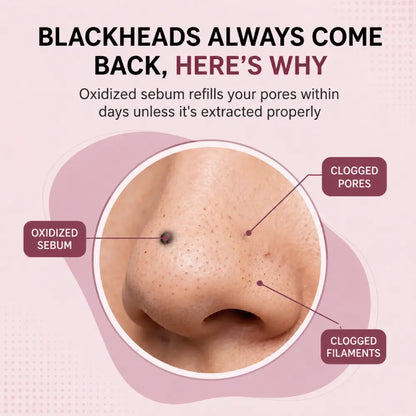 Facital Pore Remover
