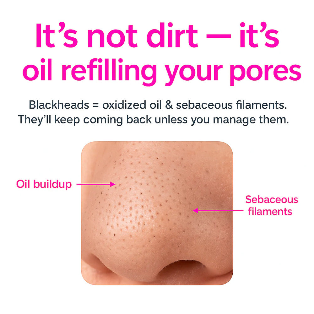 Facital Pore Remover