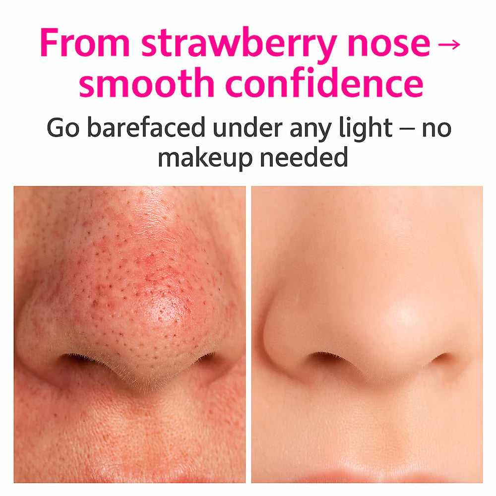 Facital Pore Remover