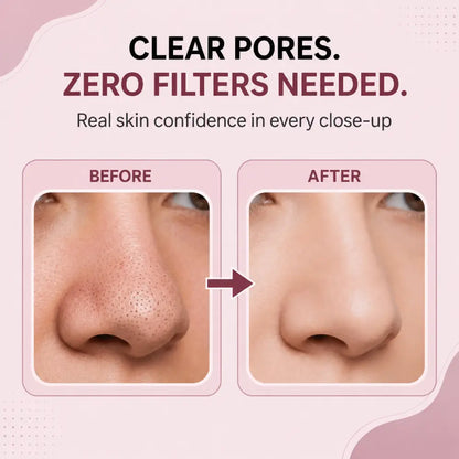Facital Pore Remover